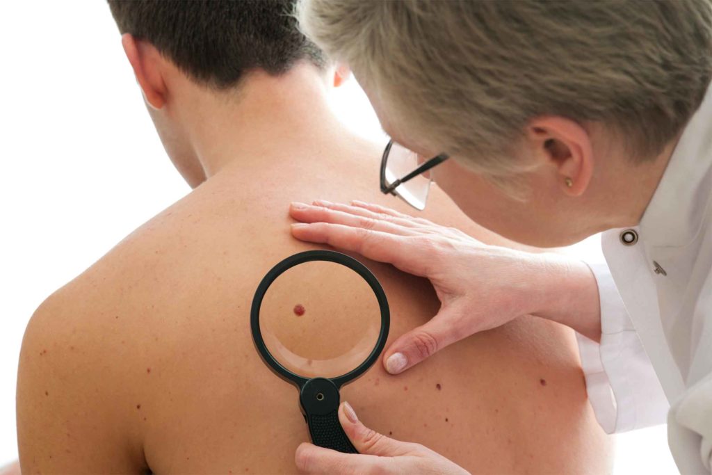 Facts About Skin Cancer by The Devonshire Clinic